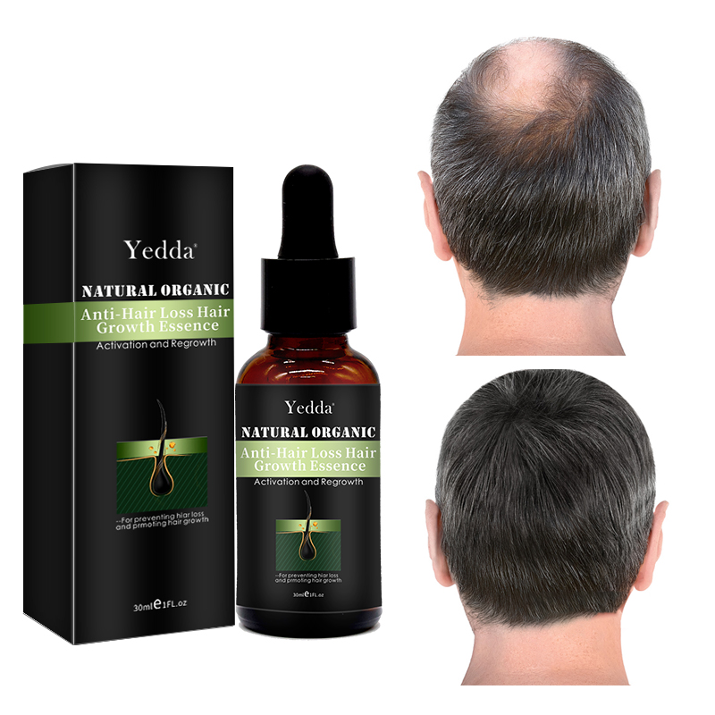 Natural Organic Vegan Herbal Hair Growth Essence Oil  - Image 3