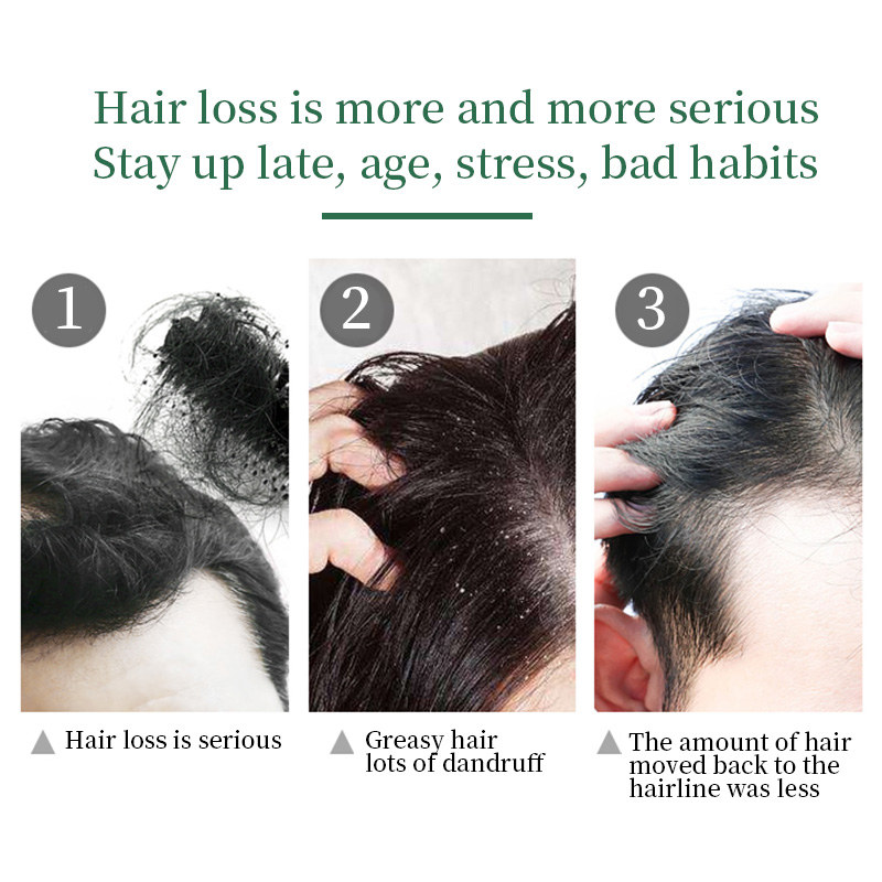Natural Organic Vegan Herbal Hair Growth Essence Oil  - Image 4